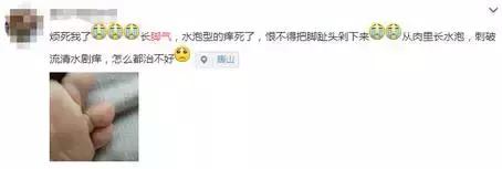 快!闻闻你的脚!听说蛮多武汉伢都有脚气