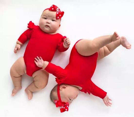 最美胎记，姐姐在胎中被弟弟“吸收”，将B超影像留在了弟弟腿上