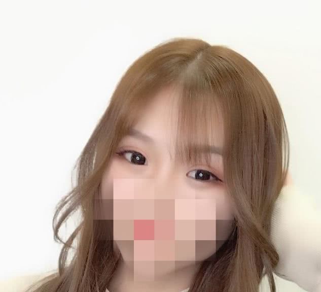 医生说我不适合做线雕,医生说我不适合做飞秒手术