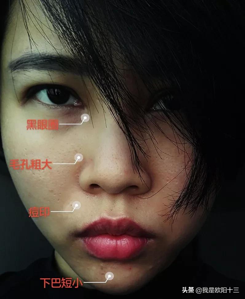 肤质很差爆痘暗沉怎么办,蜡黄暗沉起痘皮肤怎么改善