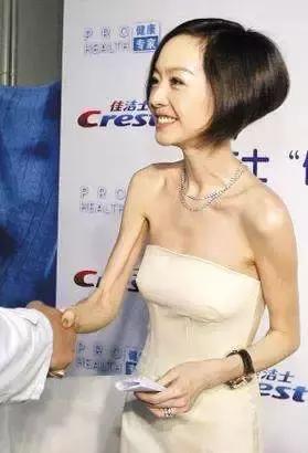 瘦的人的苦恼,瘦下来的烦恼