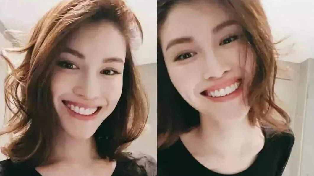 揭露欧美明星牙齿美白的秘密,牙齿美白最好的方法大黄牙