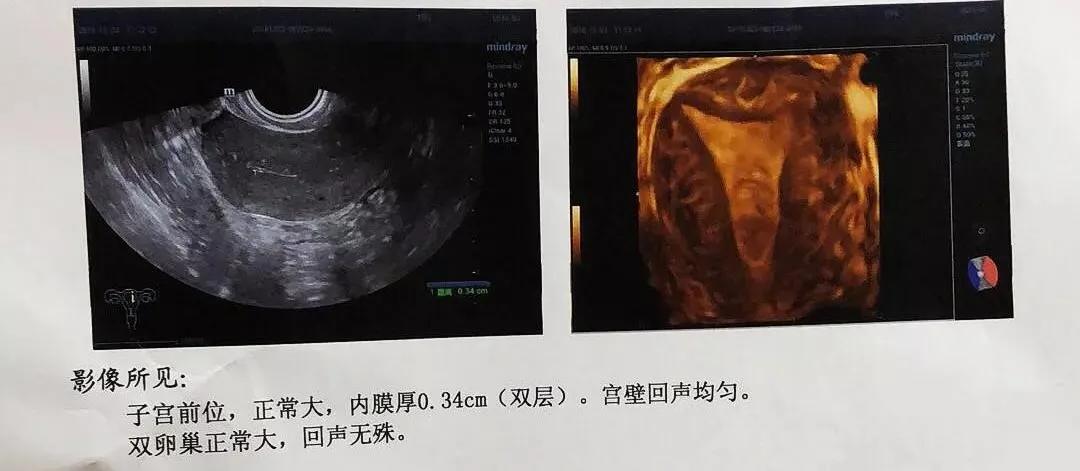 冬病夏治能治好哪些病,冬病夏治有效果没