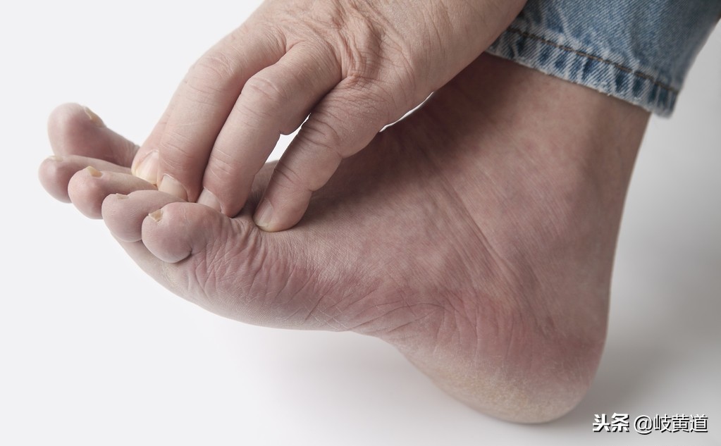 冻疮怎么预防最好办法,儿童提前预防冻疮需要涂抹什么