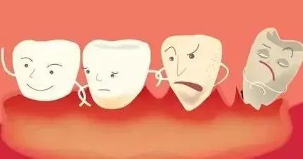 烤瓷牙取下来不戴会有影响吗,烤瓷牙需要把旁边牙齿全弄掉嘛