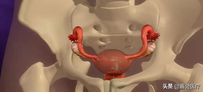 月经淋漓不尽该注意什么,子宫肌瘤5cm月经淋漓不尽怎么办