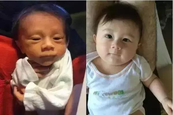 新生儿10天没有鼻梁怎么办,新生儿没有鼻梁山根