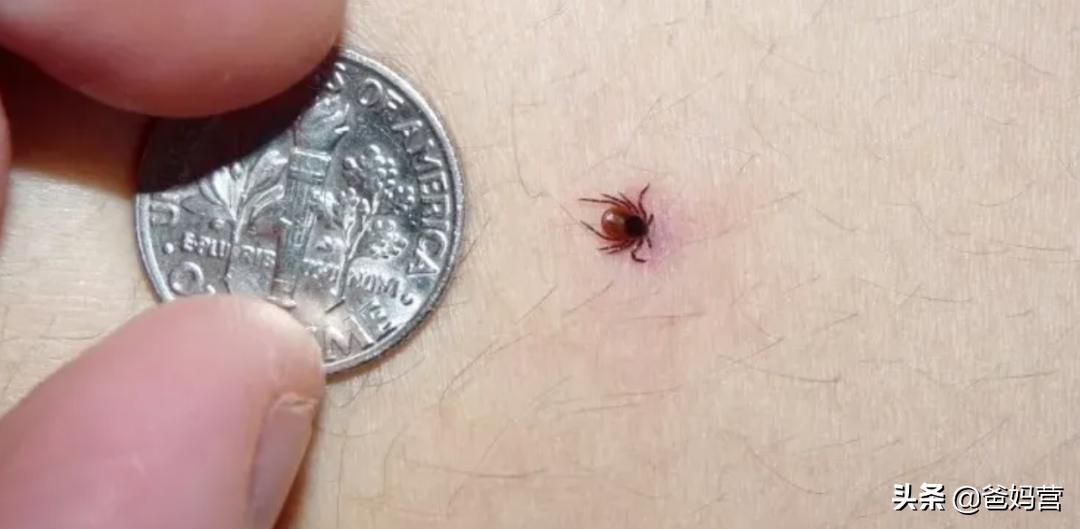 妈妈一拍小孩差点毁容,妈妈拍到孩子的恐怖画面