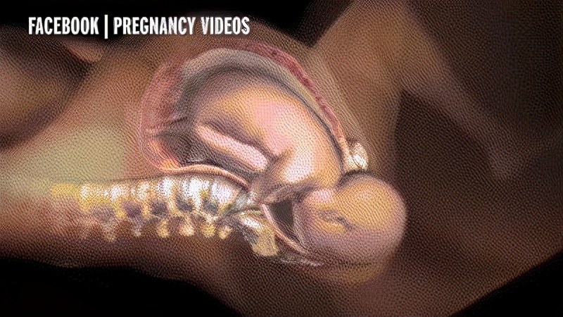 阴道松弛表现为哪些症状,阴道松弛漏尿是什么症状