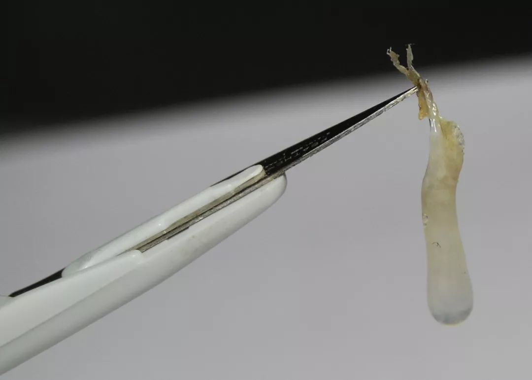 人为啥喜欢挖鼻屎,为什么我们爱抠鼻屎