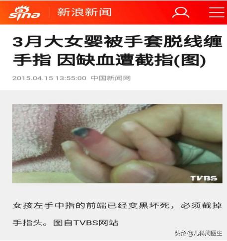 婴儿绕脖有什么危害,婴儿绕颈2圈有危险吗