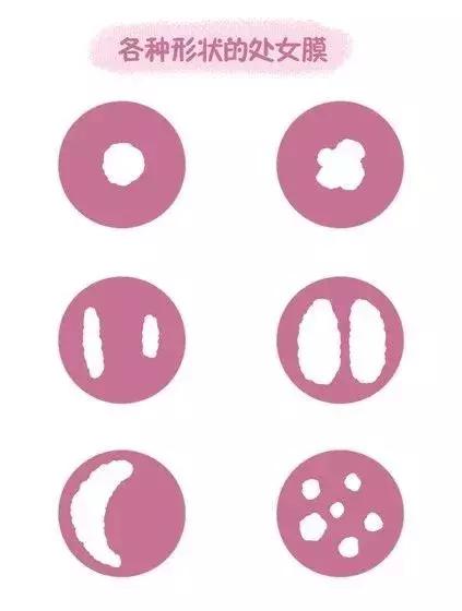 第一次*生活性**一定会流血？处女膜到底有啥作用？科普的解释来了