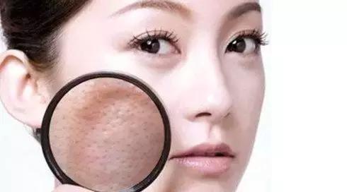 脸毛孔粗大收缩毛孔最有效的方法,脸部毛孔粗大用什么收缩毛孔最好