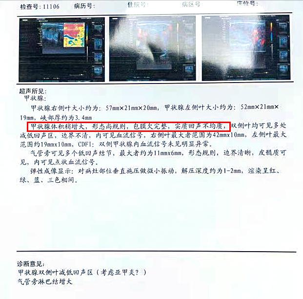 23岁女孩患甲亢的真实案例,孩子一岁三个月妈妈检查出甲亢