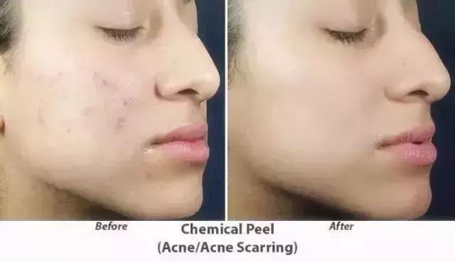 40岁的高圆圆真的保养得很好,高圆圆为啥40岁才生孩子