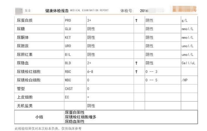 一年血肌酐从120提升到140,两年肌酐从80涨到160