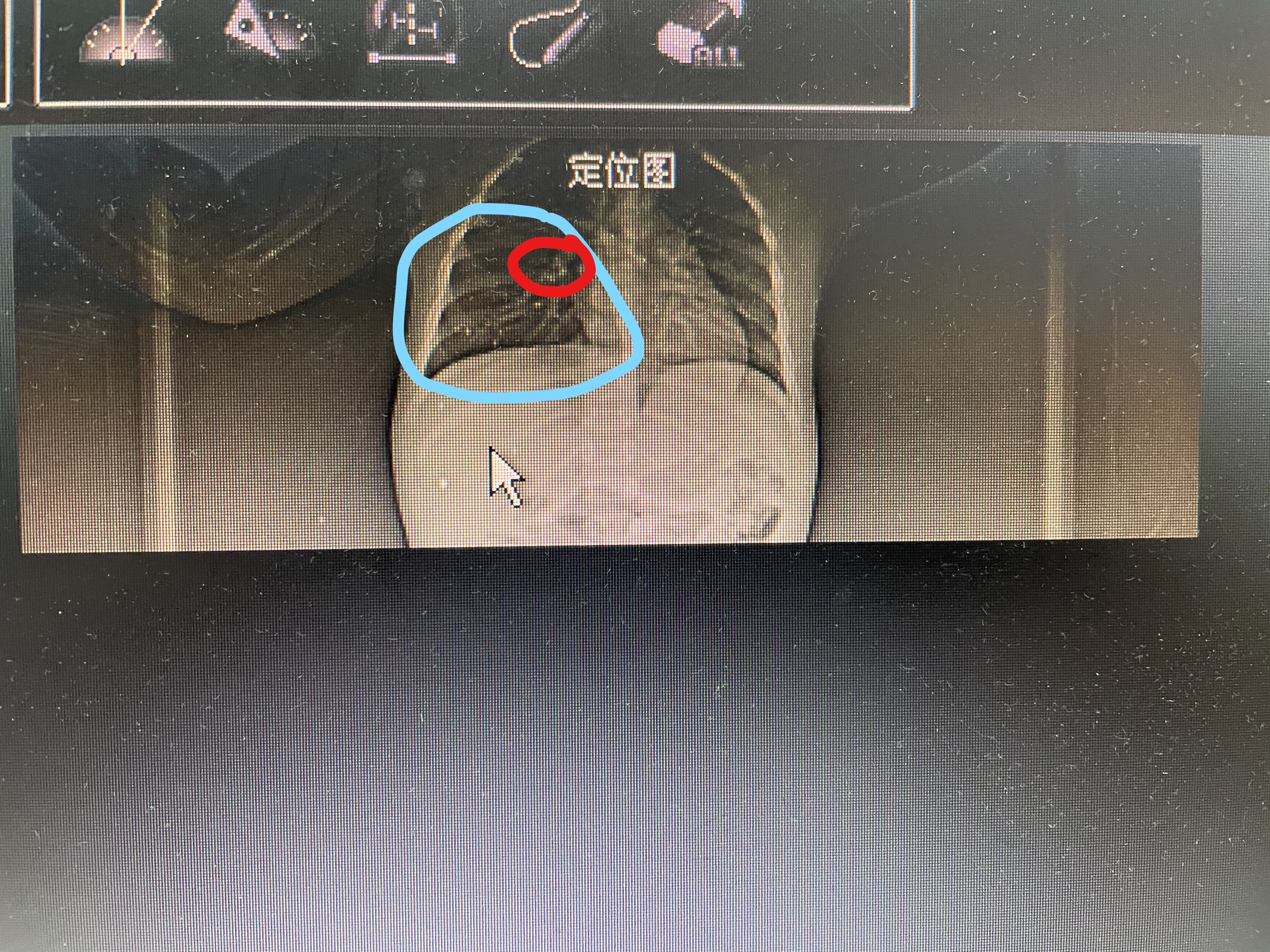 宝宝气管呛到异物反复发烧咳嗽吗,婴幼儿支气管异物咳嗽表现