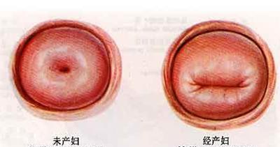 60多岁了取环要住院吗,60岁取环必须宫腔镜吗
