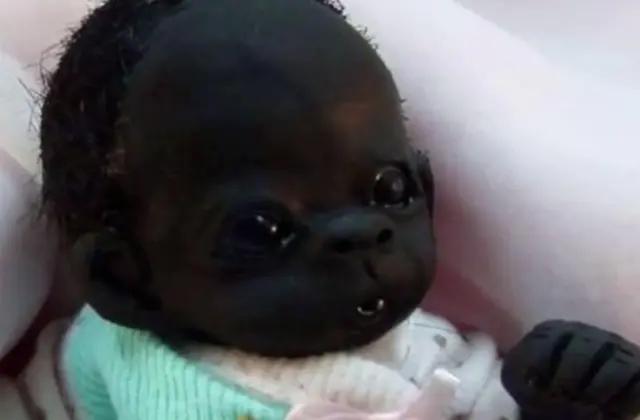 全世界最黑女婴,全世界最黑的婴儿