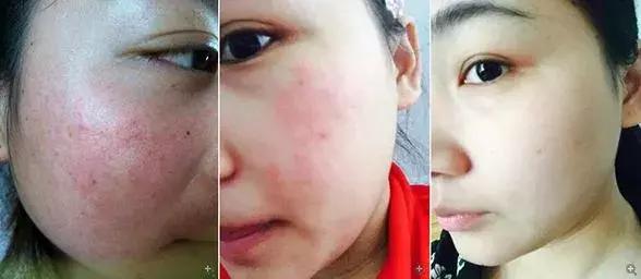 李佳琦推荐的这款日本蜜梨面霜，几分钟卖2万瓶？