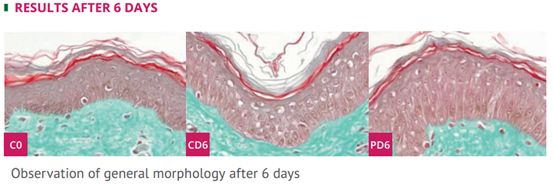 炎夏肌美白，艾喏莎珍珠膏给你健康沁养肌肤