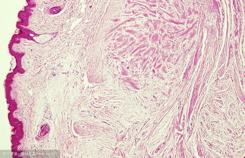 受伤了伤口愈合不了是什么病,伤口愈合后长了个肉球怎么回事