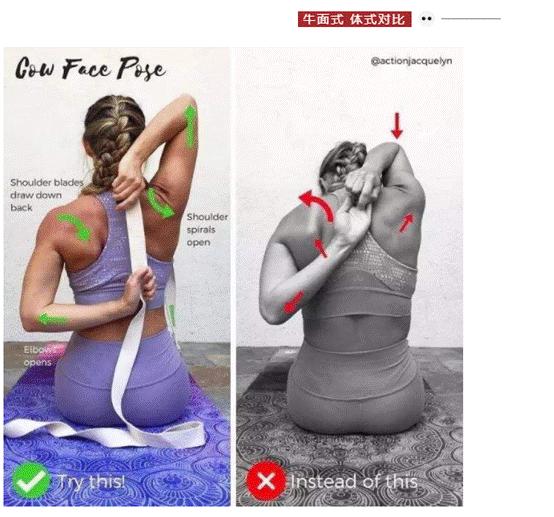 消除富贵包最简单最有效的方法,富贵包放血拔罐真的可以消除吗