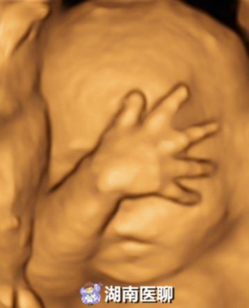 孕检四维五维,怀孕做了四维还要做二维三维吗