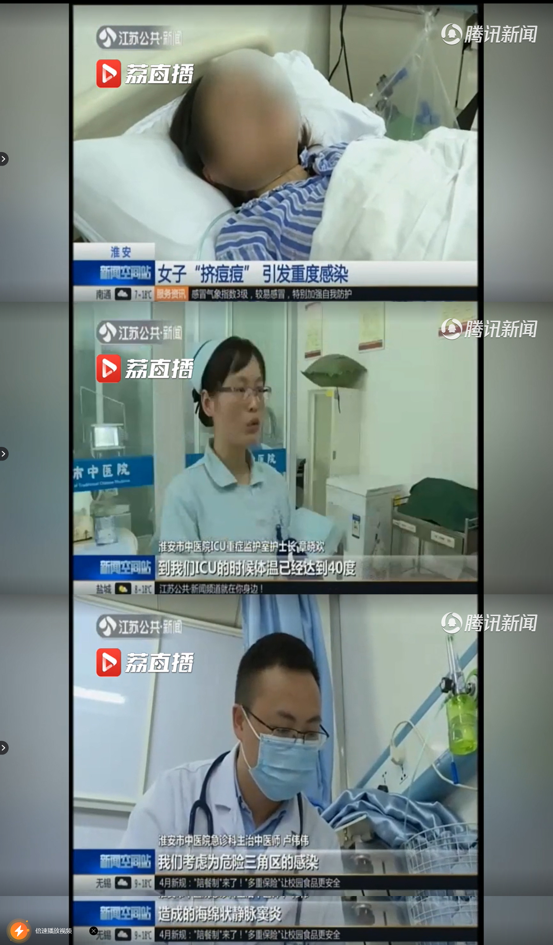 18岁女生进icu昏迷9天,18岁女孩进icu昏迷5天