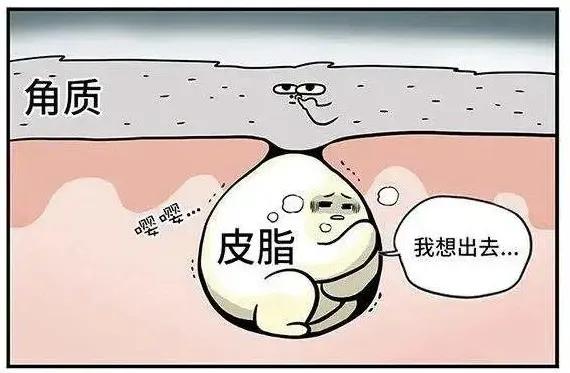 怎样去除头屑中的头皮屑,头皮屑多怎么办9个方法告别头屑