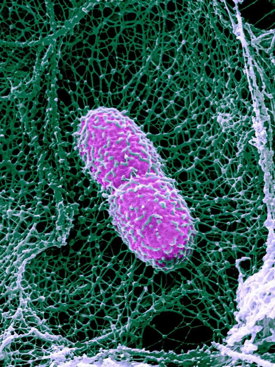 鍋囧鐥呮瘨鎰熸煋浜嗘垜,鍋囧鐥呮瘨鎰熸煋浜嗕綘