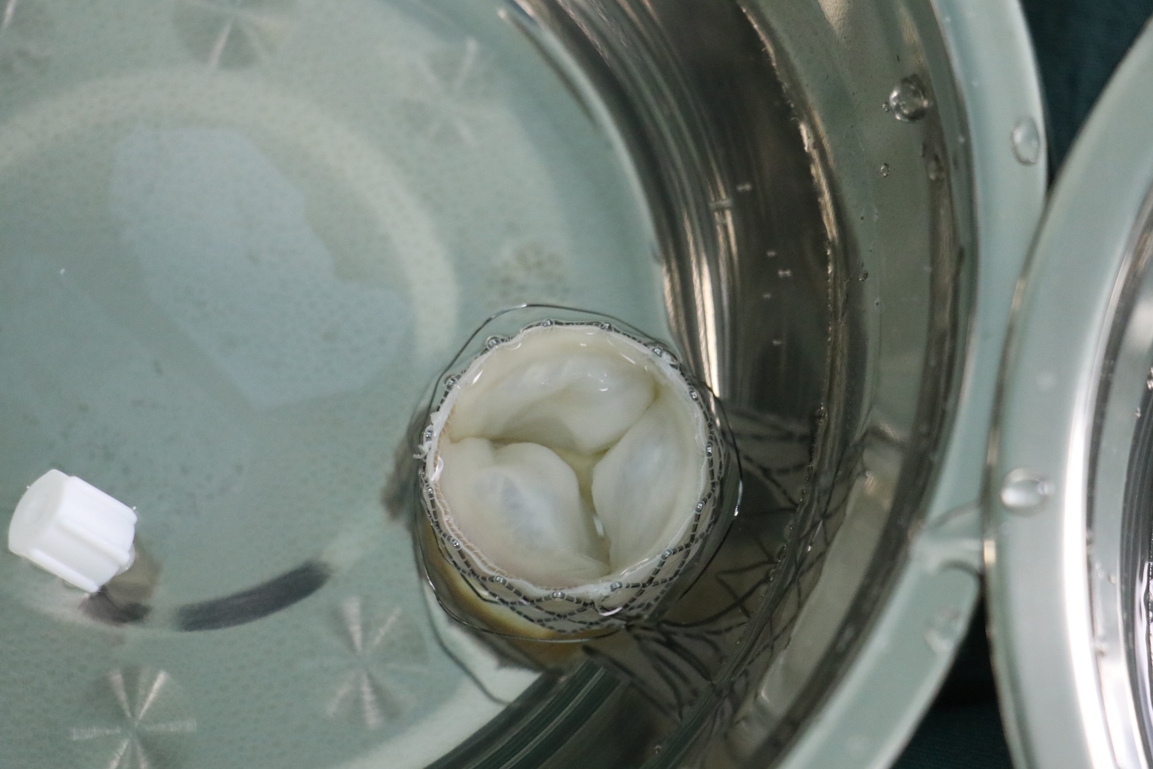 心脏病冠心病心血管疾病,冠心病心脏瓣膜病算是大病吗