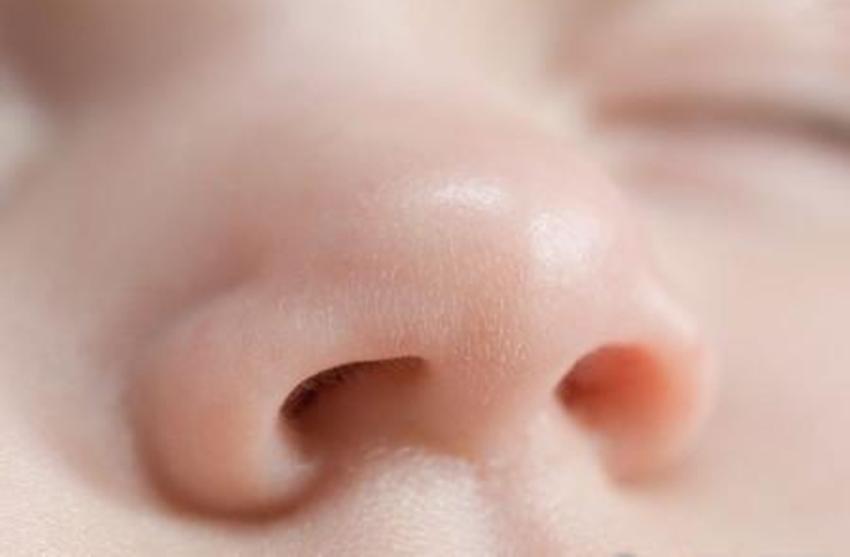 新生儿如何进行皮肤护理,新生儿皮肤常见问题照护与清洁