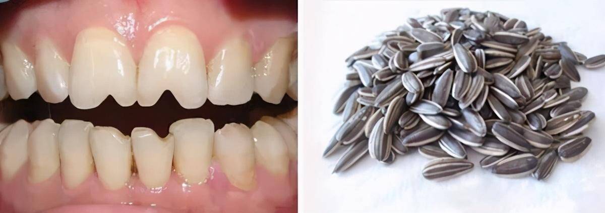 嗑出的瓜子牙终于有救了！不动手夹手，智能触摸开关续航长易携带