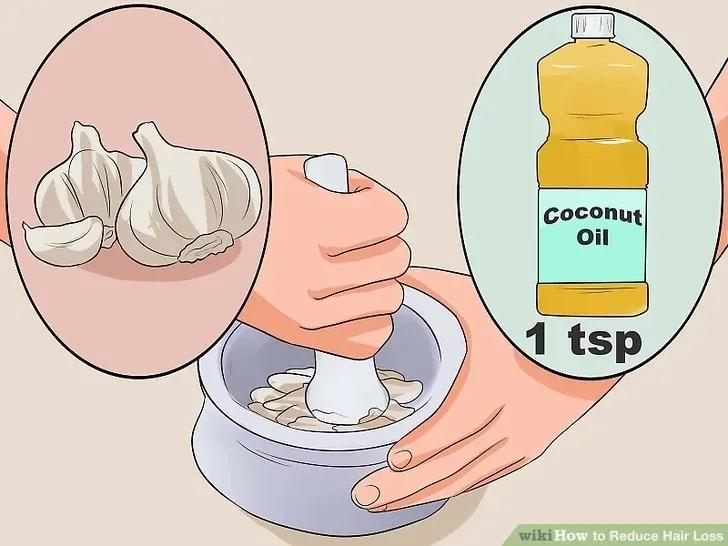 减少脱发的洗发水,脱发毛囊减少