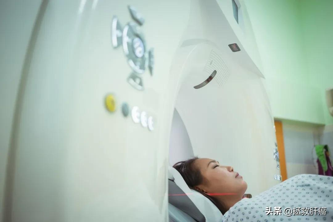 肝癌脑转移放疗后生存期,哪种类型的肝癌寿命可以活二十年