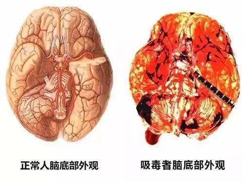 毒冰是什么,毒冰为什么叫毒冰