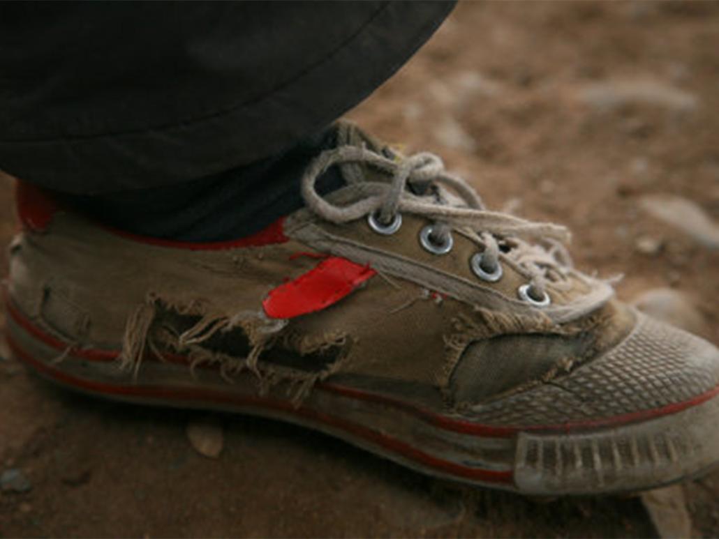 小孩鞋小导致的脚趾肿怎么消肿,小孩子穿鞋子有点紧导致脚肿