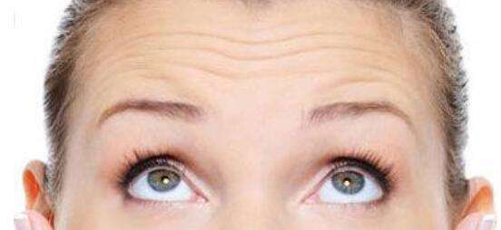 姐妹26岁抬头纹严重，被小屁孩叫“奶奶”。这次的皮肤专家找对了