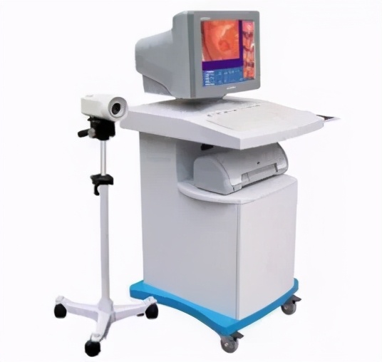 宫颈筛查结果会不会出现错误,宫颈筛查异常需要做宫腔镜吗