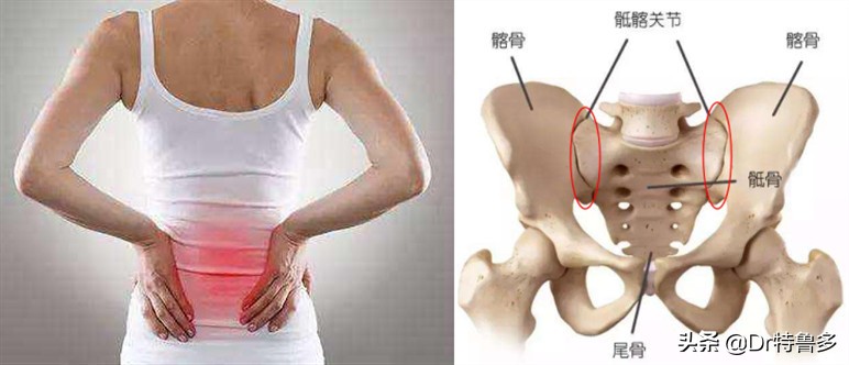 生完孩子几年打麻醉腰痛怎么办,生完宝宝后腰痛是什么原因