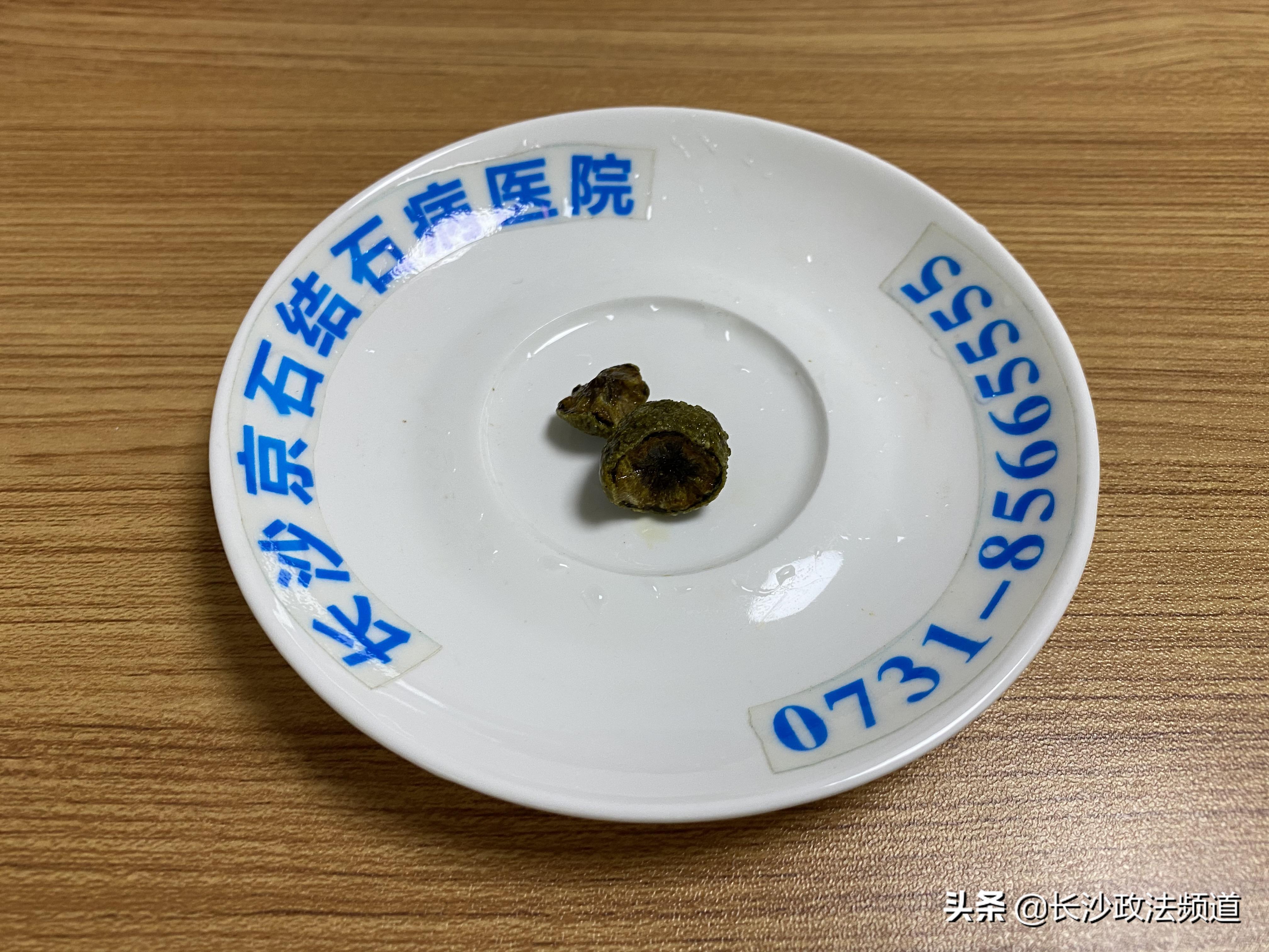 女子反复背痛,女子反复背痛肩酸