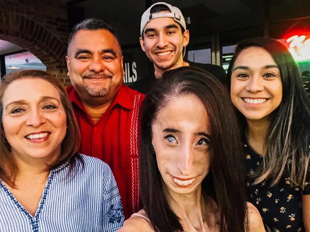 世界上最丑陋的女孩儿,世界最丑的女孩