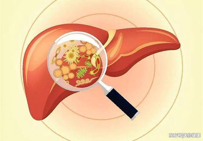 肝功能检查只有总胆汁酸偏高,肝功能总胆汁酸高的原因是什么