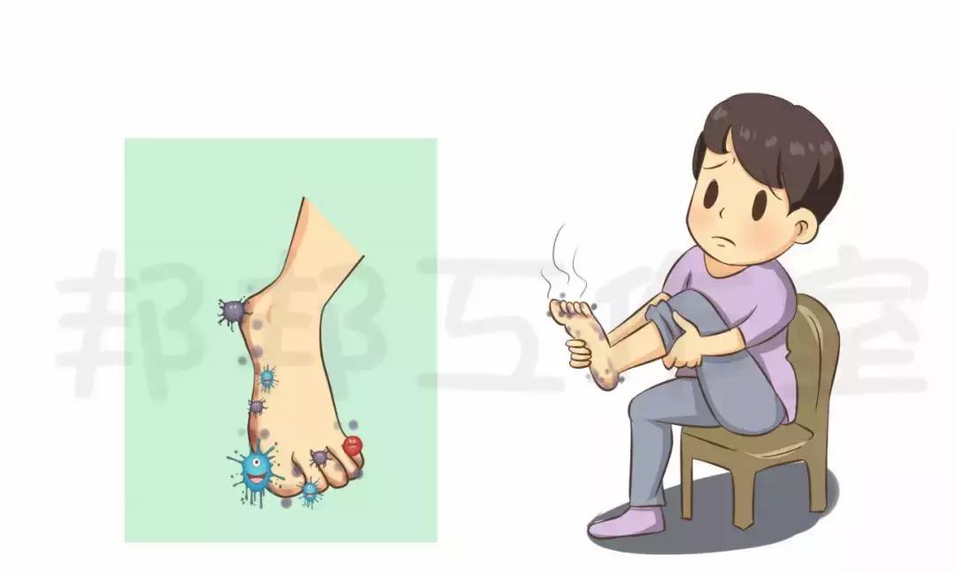 孩子得了脚气怎样才能彻底治好,藿香正气水能彻底治脚气吗