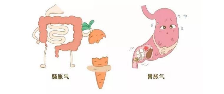 孕妈妈“胃气大”是怎么了！吃它就对了—植物乳酸杆菌299v