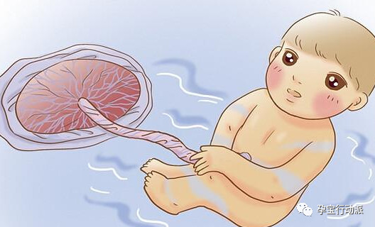 什么是脐带脱垂如何处理,臀位宝宝脐带脱垂有什么感觉