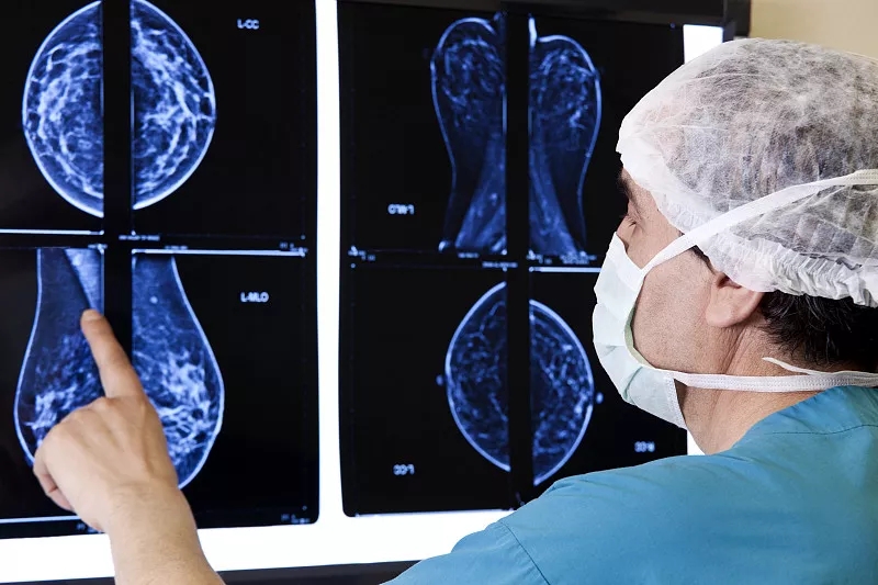 乳腺结节和增生症状有什么不一样,乳腺小叶增生的症状是什么意思