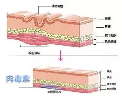 关晓彤有没有黑眼圈,关晓彤黑眼圈困扰