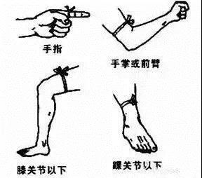 警惕蛇出没已有人被咬,在小区里被毒蛇咬伤小区有责任么